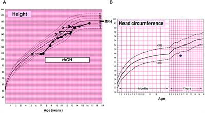 Case report: Novel SIN3A loss-of-function variant as causative for hypogonadotropic hypogonadism in Witteveen–Kolk syndrome